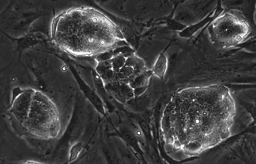 生殖細胞と万能細胞の不思議